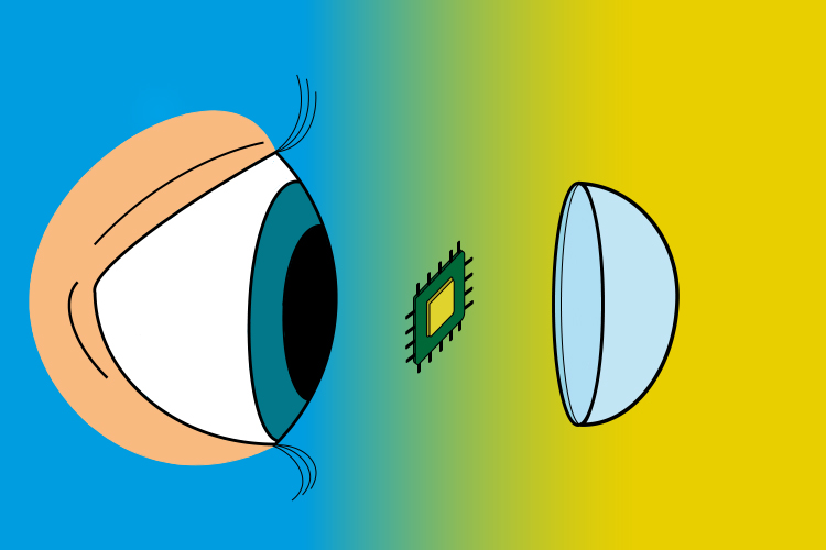 Grafik eines Auges und einer Kontaktlinse, in deren Mitte ein Prozessor steht.